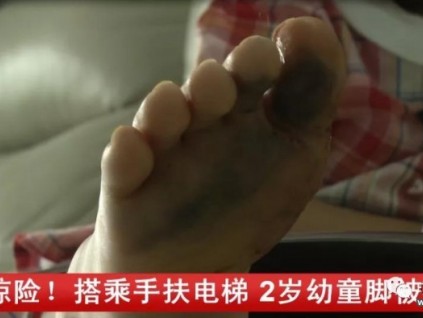 危險！2歲幼童搭乘手扶電梯，腳被卡進縫隙……